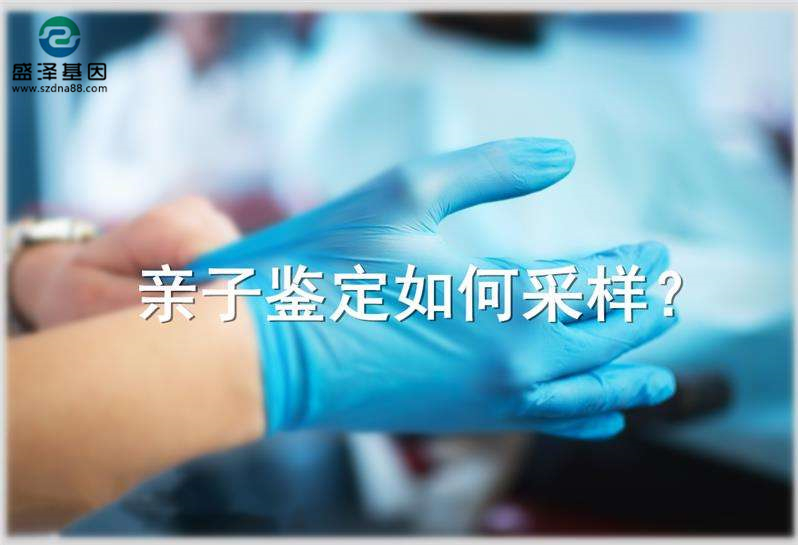 偷偷撿了一把頭發(fā)可以送去做親子鑒定嗎？