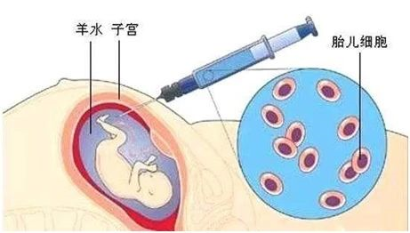無創(chuàng)胎兒親子鑒定、羊水親子鑒定、毛發(fā)親子鑒定分別怎么做？