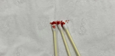 個人親子鑒定可以郵寄血樣檢材嗎？樣本有哪些注意事項(xiàng)？