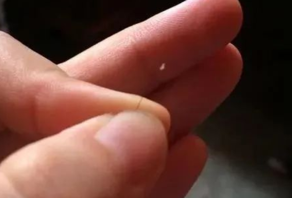 掉落的毛囊毛發(fā)可以拿去做染色體親子鑒定嗎？