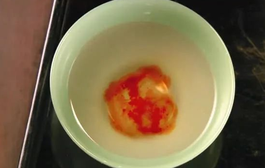 親子鑒定檢驗(yàn)血型血痕，被鑒定人應(yīng)了解自己或近親屬有無(wú)遺傳病史