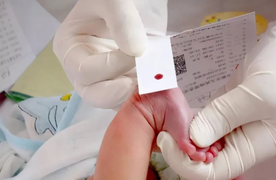 孩子出生前與出生后做親子鑒定檢測堿基有什么不同？
