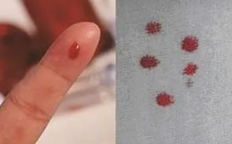 匿名親子鑒定需要準(zhǔn)備什么？親子鑒定工作人員采樣本流程有哪些？