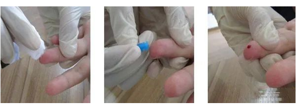 在家怎樣做親子鑒定最簡單？毛發(fā)樣本采集好后放入標(biāo)記好的信封內(nèi)