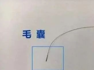 毛發(fā)可以做親子鑒定檢材嗎，怎么采集樣本才可以？