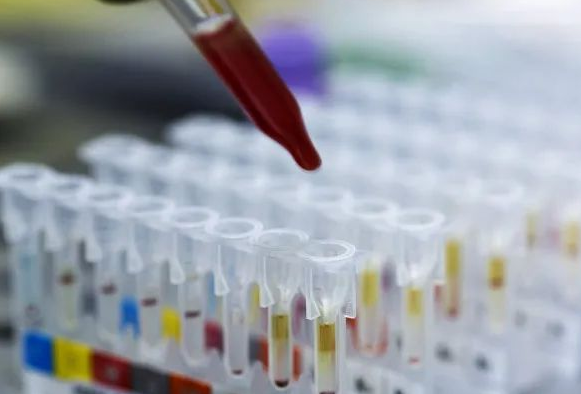 DNA親子鑒定會出錯嗎？根據樣本檢測位點出錯的概率是多少呢？
