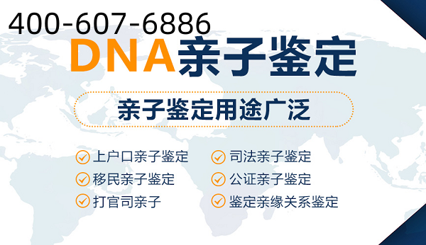 中山上戶口親子鑒定辦理有什么注意事項(xiàng)嗎？