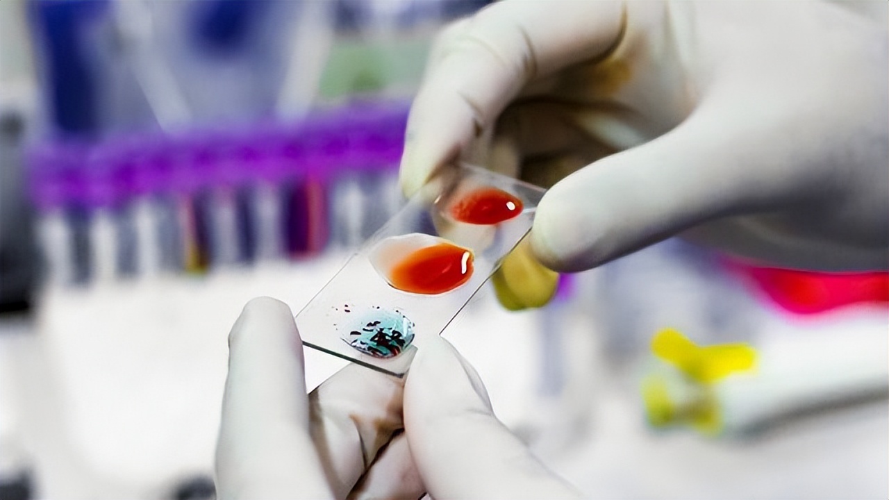 怎么用頭發(fā)做中山dna個人隱私親子鑒定？