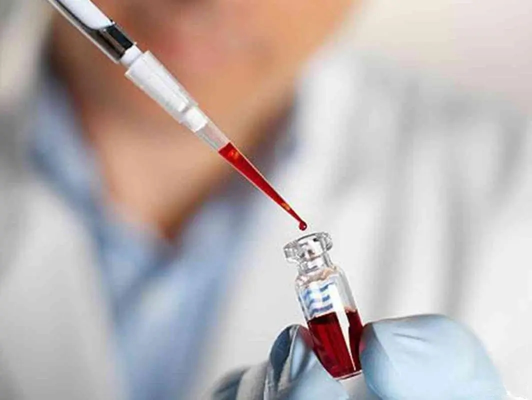 在中山如何做司法親子鑒定？中山司法局指定親子鑒定機構