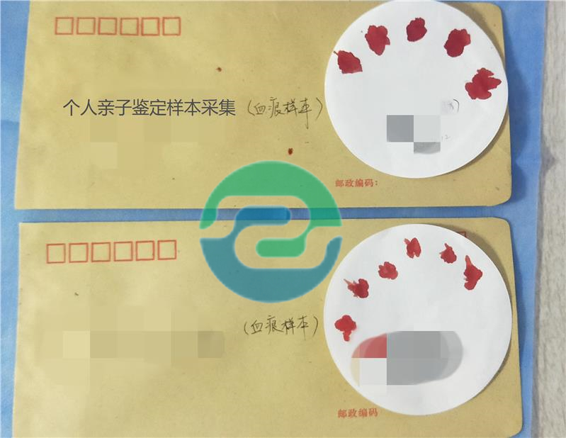 孕期中山親子鑒定結(jié)果準(zhǔn)確嗎？能相信結(jié)論嗎？